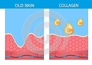 Collagen ,skin vector strabismus anatomy medical photo