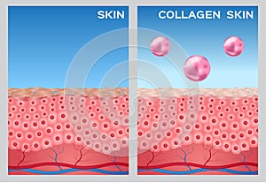Collagen turn a skin to white , white collagen