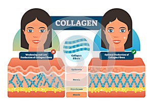 Collagen vector illustration. Medical and anatomical labeled scheme with fibers, epidermis, hypodermis and muscle. Anatomy diagram