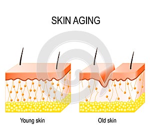 collagen in younger and older skin. collagen in younger and older skin. photo