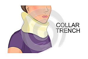 Collar trench