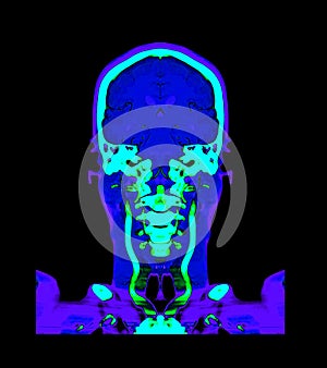 Collection colorful of CT angiography of the brain or CTA brain comparison Coronal view . Clipping path