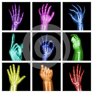 Collection of colorful x-ray hands
