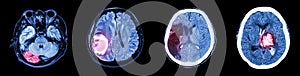 Collection CT scan of brain and multiple disease