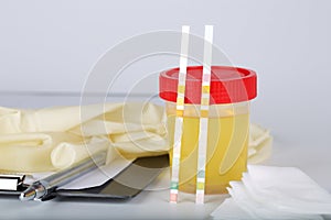 Collection cup with urine test on a table of a lab technician.