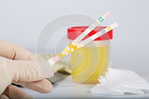 Collection cup with urine test on a table of a lab technician.