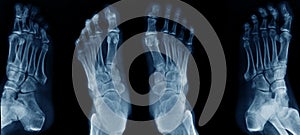 Collection foot x-ray