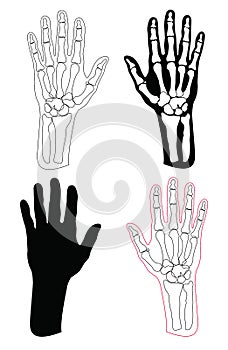 Collection of human hands and bones