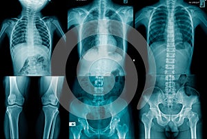 Collection human x-ray image