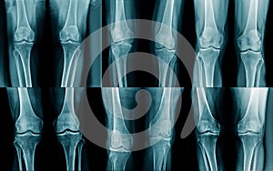 Collection leg x-ray