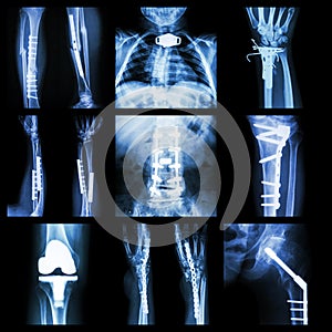 Collection of orthopedic operation