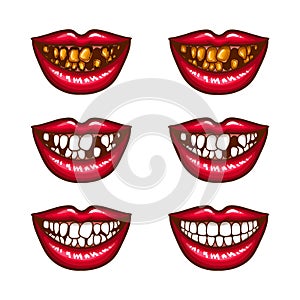 A collection of pop art icons of red female lips - smiling, with missing teeth, with spoiled teeth