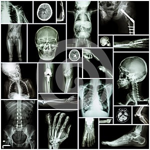 Collection X-ray