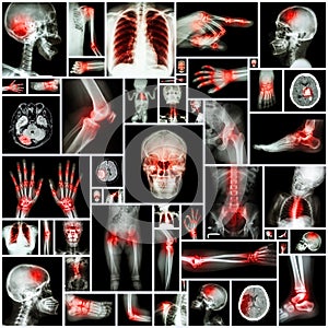 Collection X-ray multiple organ and arthritis at multiple joint (Rheumatoid,Gout)