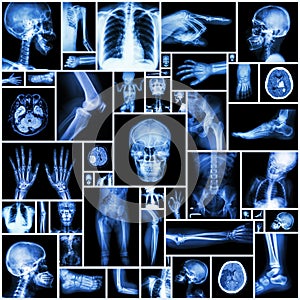 Collection X-ray multiple part of human