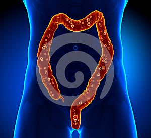 Colon Anatomy - pain
