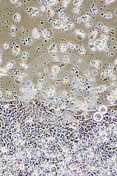 Colon Cancer cells