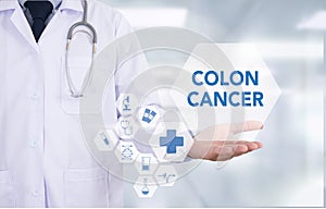 COLON CANCER photo
