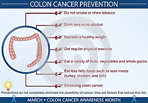 Colon Cancer Prevention Infographic Vector Illustration photo
