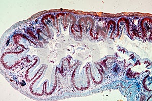 Colon with villi tissue