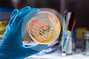 Colonies bacteria gram negative bacilli/ Gram negative cocco bacilli .