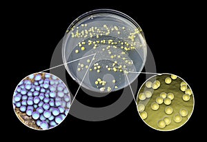 Colonies of bacteria grown from human skin
