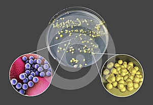 Colonies of bacteria grown from human skin