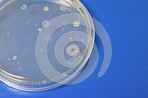 Colonies of bacteria growth on agar plate medium in laboratory