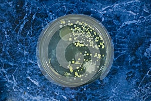 Colonies of bacteria on a petri dish.