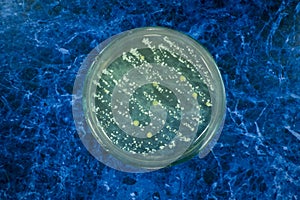 Colonies of bacteria on a petri dish. Cocci, bacilli photo