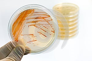 Colonies of bacteria Streptococcus agalactiae in culture medium