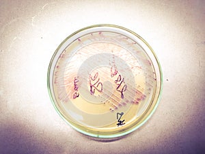 Colonies of bacterial growth culture on UTI agar media.