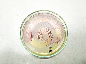 Colonies of bacterial growth culture on UTI agar media.