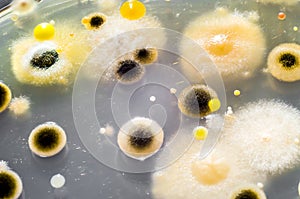 Colonies of different bacteria and mold fungi