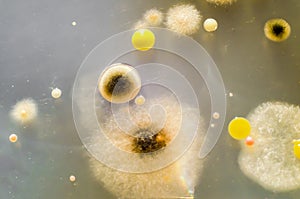 Colonies of different bacteria and mold fungi