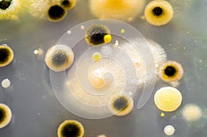 Colonies of different bacteria and mold fungi