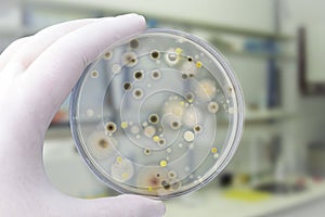 Colonies of different bacteria and mold fungi grown on Petri dish with nutrient agar