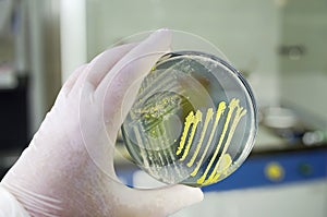 Colonies of different bacteria and mold fungi grown on Petri dish with nutrient agar