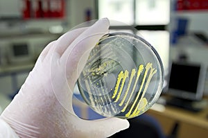 Colonies of different bacteria and mold fungi grown on Petri dish with nutrient agar