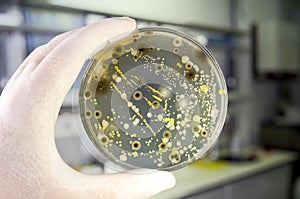 Colonies of different bacteria and mold fungi grown on Petri dish with nutrient agar