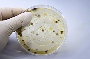 Colonies of different bacteria and mold fungi grown on Petri dish with nutrient agar