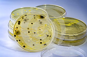 Colonies of different bacteria and mold fungi grown on Petri dish with nutrient agar
