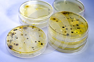 Colonies of different bacteria and mold fungi grown on Petri dish with nutrient agar