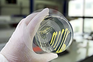 Colonies of different bacteria and mold fungi grown on Petri dish with nutrient agar