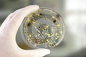 Colonies of different bacteria and mold fungi grown on Petri dish with nutrient agar