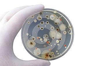 Colonies of different bacteria and mold fungi grown on Petri dish with nutrient agar