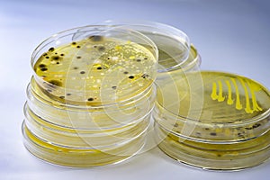 Colonies of different bacteria and mold fungi grown on Petri dish with nutrient agar