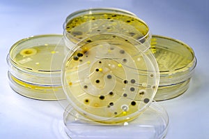 Colonies of different bacteria and mold fungi grown on Petri dish with nutrient agar