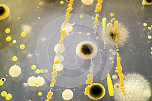 Colonies of different bacteria and mold fungi grown on Petri dish with Tryptic soy agar