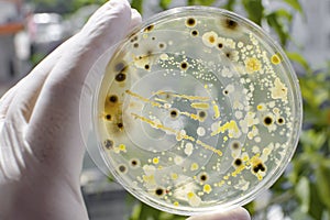 Colonies of different bacteria and molds